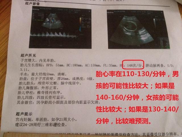 三个月B超观察胎儿性别的方法解析