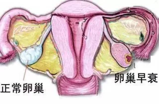 关于三个月没来月经是否正常的问题解析