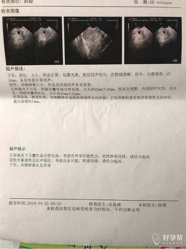 停经两个月未见孕囊，原因解析与健康建议