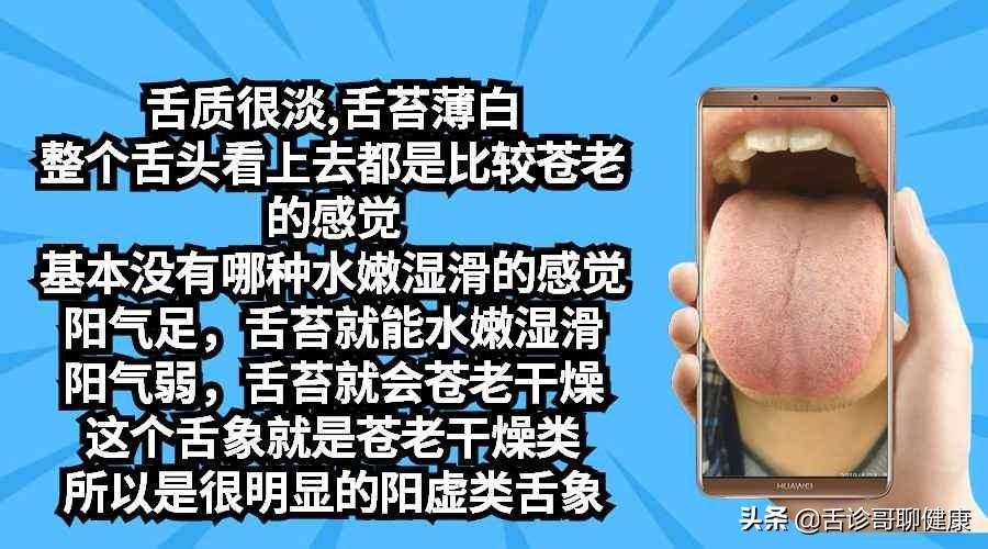 胃胀气困扰持续半个月，原因、症状与解决方案